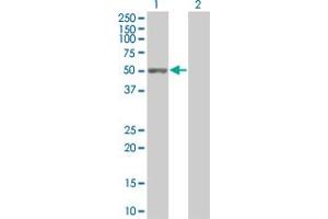 Western Blot analysis of C9orf68 expression in transfected 293T cell line by C9orf68 MaxPab polyclonal antibody. (C9orf68 抗体  (AA 1-392))