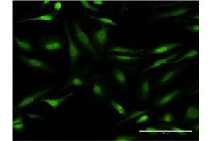 Immunofluorescence of monoclonal antibody to CALCOCO2 on HeLa cell. (CALCOCO2 抗体  (AA 347-446))