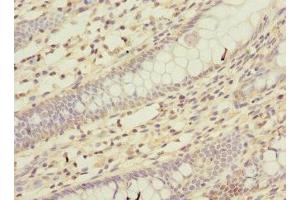 Immunohistochemistry (IHC) image for anti-Potassium Voltage-Gated Channel, Shal-Related Subfamily, Member 2 (KCND2) (AA 501-630) antibody (ABIN7163978)