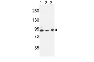 Western Blotting (WB) image for anti-DnaJ (Hsp40) Homolog, Subfamily C, Member 6 (DNAJC6) antibody (ABIN3004410) (DNAJC6 抗体)