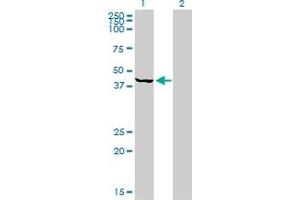 Western Blot analysis of PSMC6 expression in transfected 293T cell line by PSMC6 monoclonal antibody (M02), clone 2C4.