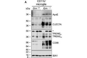 Western Blotting (WB) image for anti-Ionized Calcium-binding Adapter Molecule 1 (IBA1) (C-Term) antibody (ABIN2857032)