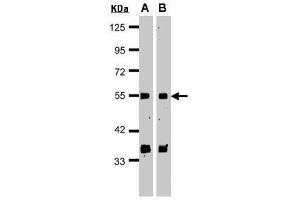 WB Image Sample(30 μg of whole cell lysate) A:HeLa S3 , B:MOLT4 , 15% SDS PAGE antibody diluted at 1:1000 (GPS1 抗体  (C-Term))