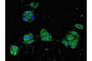 Immunofluorescent analysis of HepG2 cells using ABIN7151001 at dilution of 1:100 and Alexa Fluor 488-congugated AffiniPure Goat Anti-Rabbit IgG(H+L) (ZNF645 抗体  (AA 200-413))