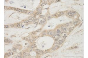 Immunohistochemistry (IHC) image for anti-BCL2-Associated Agonist of Cell Death (BAD) (AA 1-50) antibody (ABIN7448932)