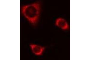 ABIN6277699 staining A549 cells by IF/ICC. (CSTA 抗体  (C-Term))