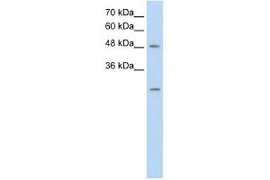 ANKRD2 antibody used at 0. (ANKRD2 抗体)
