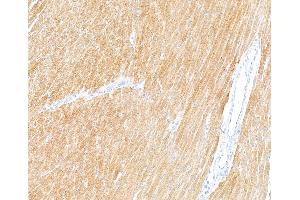Immunohistochemistry (IHC) image for anti-Troponin I (TNNI) (AA 1-50) antibody (ABIN7795679)