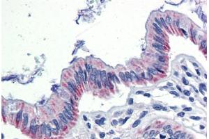 Human Colon (formalin-fixed, paraffin-embedded) stained with EGR2 antibody ABIN462263 followed by biotinylated goat anti-rabbit IgG secondary antibody ABIN481713, alkaline phosphatase-streptavidin and chromogen. (EGR2 抗体  (AA 397-446))