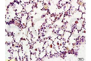 Formalin-fixed and paraffin embedded rat brain tissue labeled with Anti-Synaptotagmin 1/SYT1 Polyclonal Antibody, Unconjugated (ABIN754888) at 1:200 followed by conjugation to the secondary antibody, (SP-0023), and DAB staining (Synaptotagmin 抗体  (AA 165-260))