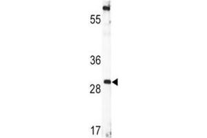 Western blot analysis of BDNF antibody and CEM lysate. (BDNF 抗体  (AA 206-236))