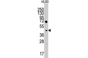 Western blot analysis of LEFTY1 polyclonal antibody  in HL-60 cell line lysates (35 ug/lane). (LEFTY1 抗体  (AA 291-320))