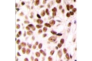 Immunohistochemistry (IHC) image for anti-ATP-Binding Cassette, Sub-Family C (CFTR/MRP), Member 9 (ABCC9) (N-Term) antibody (ABIN7303130)