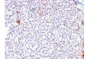 Immunohistochemistry (IHC) image for anti-V-Akt Murine Thymoma Viral Oncogene Homolog 1 (AKT1) (AA 85-189) antibody (ABIN6939337)