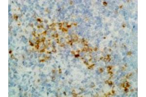Immunohistochemical staining (Formalin-fixed paraffin-embedded sections) of human tonsil with Human IgG (gamma heavy chain) monoclonal antibody, clone RM116 (Biotin) . (兔 anti-人 Immunoglobulin Heavy Constant gamma 1 (G1m Marker) (IGHG1) Antibody (Biotin))