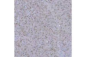 IHC analysis of SF3A3 using anti-SF3A3 antibody (ABIN7599863).