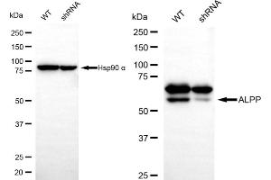 Western blotting analysis using ALPP antibody (ABIN7799843).