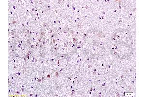 Formalin-fixed and paraffin embedded rat brain tissue labeled with Anti-FOXC1/FREAC3 Polyclonal Antibody, Unconjugated (ABIN719291) at 1:200 followed by conjugation to the secondary antibody and DAB staining (FOXC1 抗体  (AA 101-200))