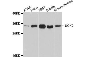 Western blot analysis of extracts of various cell lines, using UCK2 antibody (ABIN5999140) at 1/1000 dilution. (UCK2 抗体)