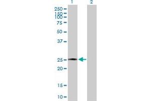 Western Blot analysis of AMELX expression in transfected 293T cell line by AMELX MaxPab polyclonal antibody. (AMELX 抗体  (AA 1-191))
