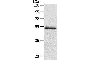 Western blot analysis of Human normal colon sigmoideum tissue, using OLFM4 Polyclonal Antibody at dilution of 1:200 (Olfactomedin 4 抗体)