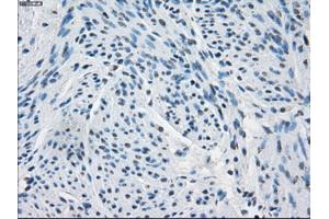 Immunohistochemical staining of paraffin-embedded endometrium tissue using anti-FHmouse monoclonal antibody. (FH 抗体)