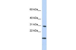 WB Suggested Anti-POLR2K Antibody Titration:  0. (POLR2K 抗体  (Middle Region))