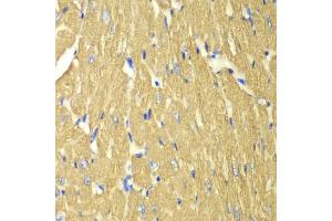 Immunohistochemistry of paraffin-embedded mouse heart using TPM3 antibody (ABIN6291029) at dilution of 1:100 (40x lens). (TPM3 抗体)