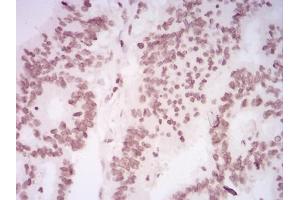 Immunohistochemistry (IHC) image for anti-Histone Cluster 2, H4a (HIST2H4A) (meLys20) antibody (ABIN5684092)