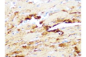 Immunohistochemistry of paraffin-embedded mouse heart using Myosin heavy chain Rabbit mAb (ABIN7268750) at dilution of 1:100 (40x lens). (MYH7 抗体)