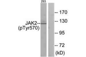 Western blot analysis of extracts from 293 cells treated with etoposide 25uM 24h, using JAK2 (Phospho-Tyr570) Antibody. (JAK2 抗体  (pTyr570))