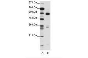 Image no. 1 for anti-Methyl-CpG Binding Domain Protein 1 (MBD1) (C-Term) antibody (ABIN202746)
