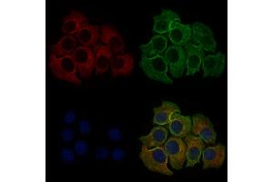 ABIN6257434 and ABIN6273695 staining Hela cells by IF/ICC. (PLCE1 抗体)