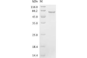 (Tris-Glycine gel) Discontinuous SDS-PAGE (reduced) with 5 % enrichment gel and 15 % separation gel.
