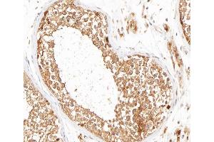 ABIN6266593 at 1/100 staining human testis tissue sections by IHC-P. (MMP16 抗体  (C-Term))