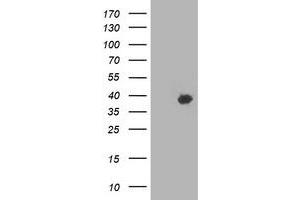 Western Blotting (WB) image for anti-HSPA Binding Protein, Cytoplasmic Cochaperone 1 (HSPBP1) antibody (ABIN1498758) (HSPBP1 抗体)