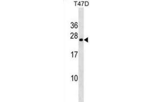 Western Blotting (WB) image for anti-Variable Charge, X-Linked 3A (VCX3A) antibody (ABIN3000418) (VCX3A 抗体)