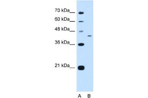 WB Suggested Anti-KIAA0515 Antibody Titration:  0. (PRRC2B 抗体  (N-Term))