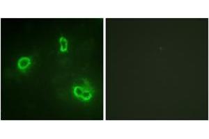 Immunofluorescence analysis of COS7 cells, using p90 RSK (Ab-573) Antibody. (RPS6KA3 抗体  (AA 539-588))