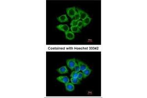 ICC/IF Image Immunofluorescence analysis of methanol-fixed A431, using EEF1D, antibody at 1:200 dilution. (EEF1D 抗体)