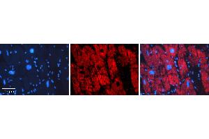 Rabbit Anti-ERP29 Antibody   Formalin Fixed Paraffin Embedded Tissue: Human heart Tissue Observed Staining: Cytoplasmic Primary Antibody Concentration: 1:100 Other Working Concentrations: N/A Secondary Antibody: Donkey anti-Rabbit-Cy3 Secondary Antibody Concentration: 1:200 Magnification: 20X Exposure Time: 0. (ERP29 抗体  (N-Term))
