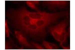 Image no. 1 for anti-Breakpoint Cluster Region (BCR) (Tyr177) antibody (ABIN197420) (BCR 抗体  (Tyr177))