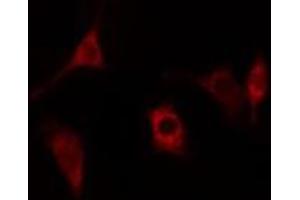 ABIN6278432 staining Hela cells by IF/ICC. (Cathepsin H 抗体  (Internal Region))