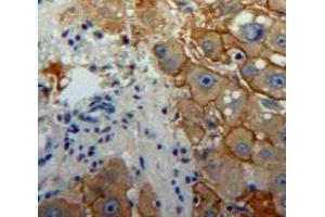 Used in DAB staining on fromalin fixed paraffin-embedded Liver tissue (Interferon gamma 抗体  (AA 24-166))