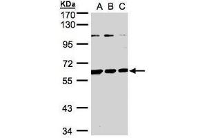 WB Image Sample(30 ug whole cell lysate) A:H1299 B:HeLa S3, C:Hep G2 , 7. (BIVM 抗体  (C-Term))