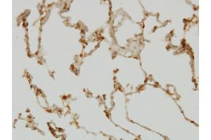 Immunoperoxidase of monoclonal antibody to SH2D4A on formalin-fixed paraffin-embedded human lung. (SH2D4A 抗体  (AA 239-338))