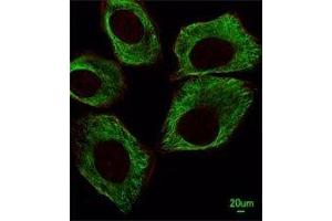 Immunofluorescent analysis of A549 cells using beta-Tubulin antibody at 1:25 dilution. (TUBB1 抗体)