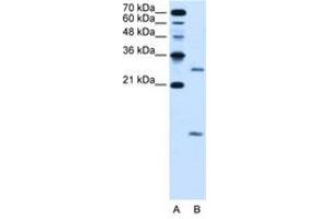 Image no. 2 for anti-Vacuolar H+-ATPase Homolog (VMA21) (N-Term) antibody (ABIN205060) (VMA21 抗体  (N-Term))