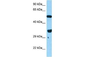 Host:  Mouse  Target Name:  FOXL1  Sample Tissue:  Mouse Skeletal Muscle  Antibody Dilution:  1ug/ml (FOXL1 抗体  (N-Term))