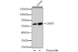 Western blot analysis of extracts of Jurkat cells, using CASP2 antibody. (Caspase 2 抗体  (AA 153-452))